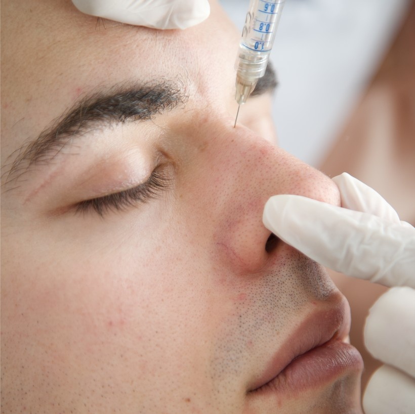 Tratamiento de rellenos faciales con ácido hialurónico